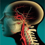 Transcranial Doppler Basic Anatomy(3 Credits CME)